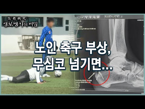 [노인운동] 축구로 인한 통증, 노인인 경우 무심코 넘기면 건강을 위협한다 (KBS 20220525 방송)